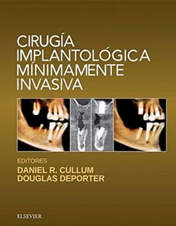 Cirugia implantologica minimamente invasiva
