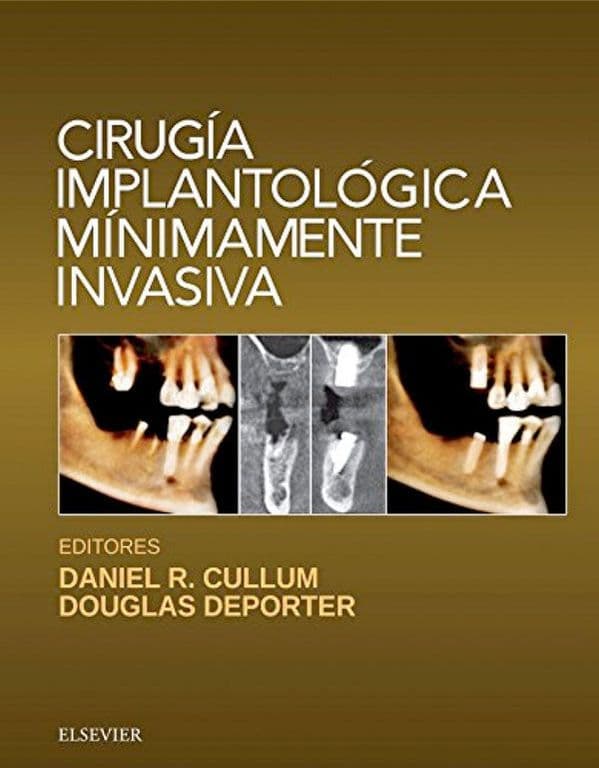 Cirugia implantologica minimamente invasiva